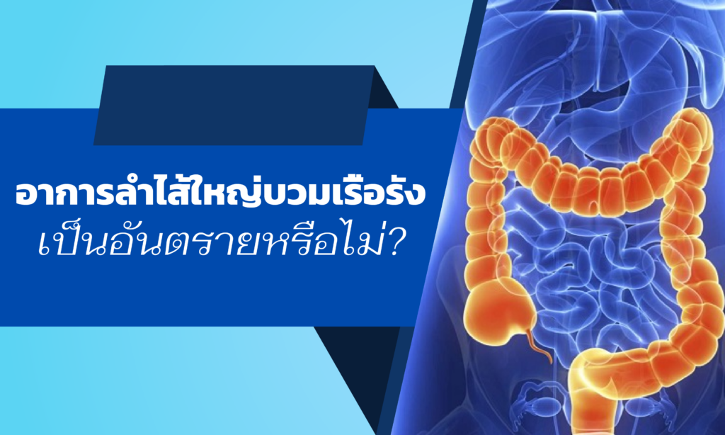 โรคลำไส้ใหญ่อักเสบเรื้อรัง (หรือกลุ่มอาการของโรคที่มีการอักเสบเรื้อรังของทางเดินอาหาร - IBD) เป็นโรคอักเสบเรื้อรังที่ส่งผลต่อเยื่อเมือกลำไส้ใหญ่ ในกรณีที่ไม่รุนแรง เยื่อเมือกลำไส้ใหญ่จะถูกทำลายง่ายและมีเลือดออก ในกรณีที่รุนแรง โรคนี้อาจทำให้เกิดแผล รอยฟกช้ำปรากฏขึ้น และอาจทำให้เกิดฝีได้