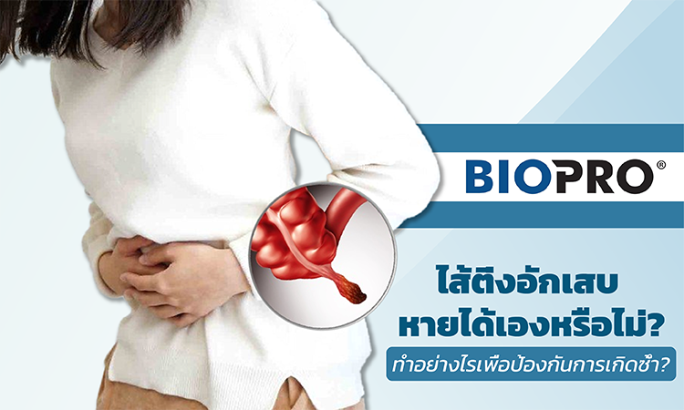 ไส้ติ่งอักเสบ หายได้เองหรือไม่? ทำอย่างไร เพื่อป้องกันการเกิดซ้ำ?