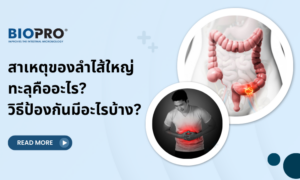 สาเหตุของลำไส้ใหญ่ทะลุคืออะไร? วิธีป้องกันมีอะไรบ้าง?