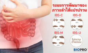 ขั้นตอนของการพัฒนาอาการลำไส้แปรปรวน