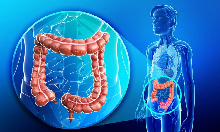 IBS - ความเสี่ยงที่อาจเกิดขึ้นต่อสุขภาพของทุกคน