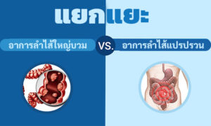 อาการต่างๆ ช่วยให้คุณแยกแยะระหว่างอาการลำไส้ใหญ่บวมและลำไส้ใหญ่กระตุกได้