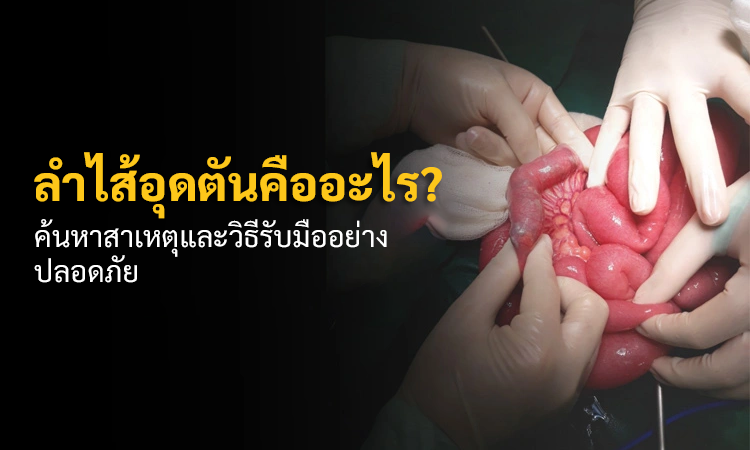 ลำไส้อุดตันคืออะไร? ค้นหาสาเหตุและวิธีรับมืออย่างปลอดภัย